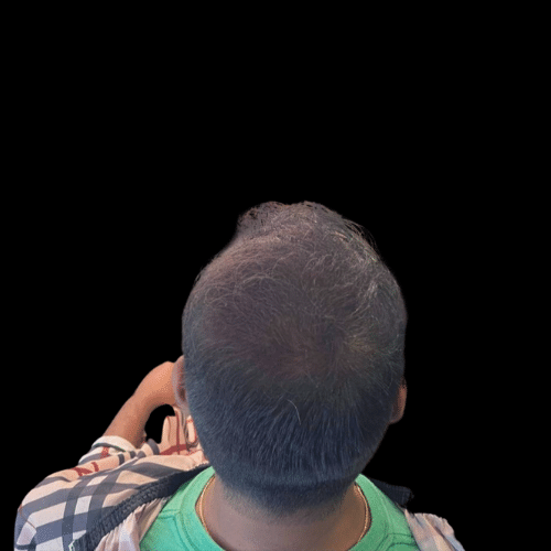 Hair enhancement